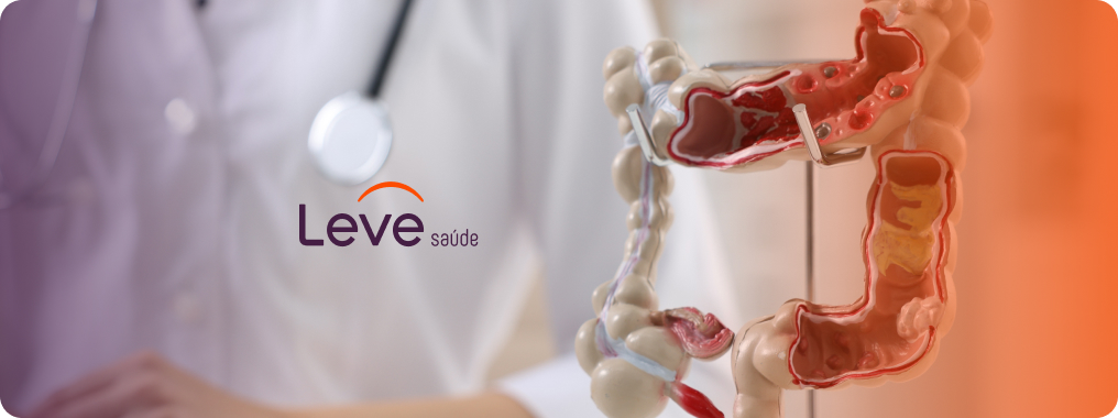 Colonoscopia: o que é, como é feito, e por que é importante para a prevenção do câncer